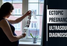 Ectopic Pregnancy: Ultrasound Diagnosis