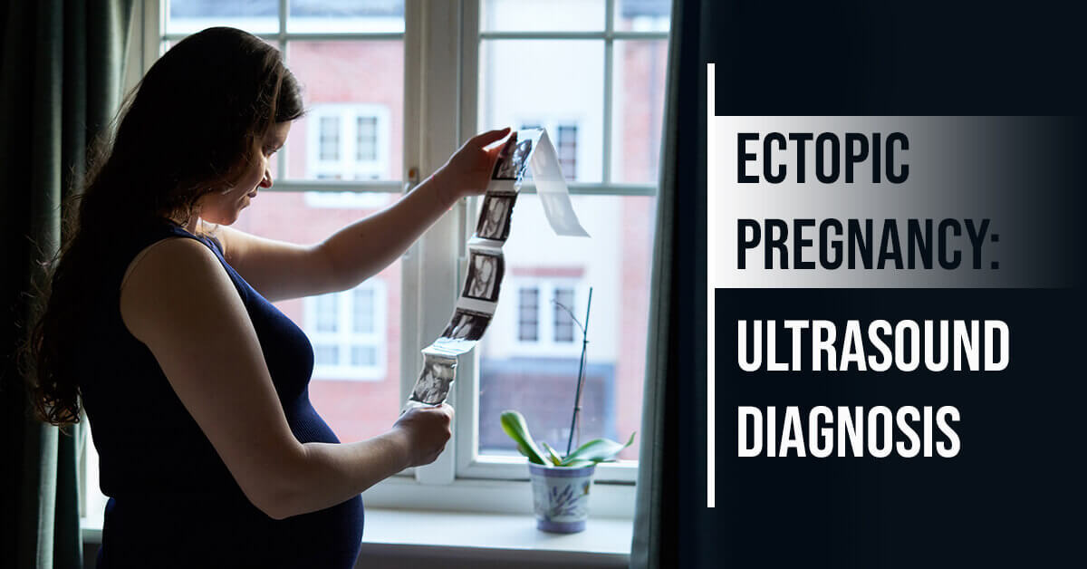 Ectopic Pregnancy: Ultrasound Diagnosis