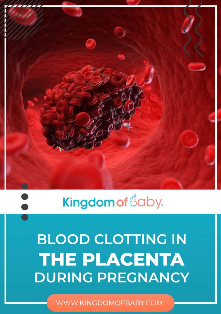 Blood Clotting in the Placenta During Pregnancy