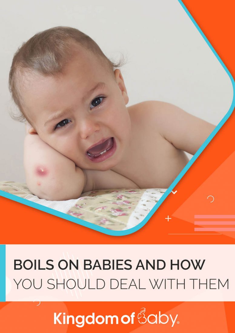 Boils on Babies and How You Should Deal with Them