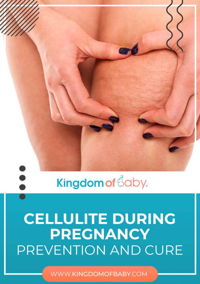 Cellulite During Pregnancy: Prevention and Cure