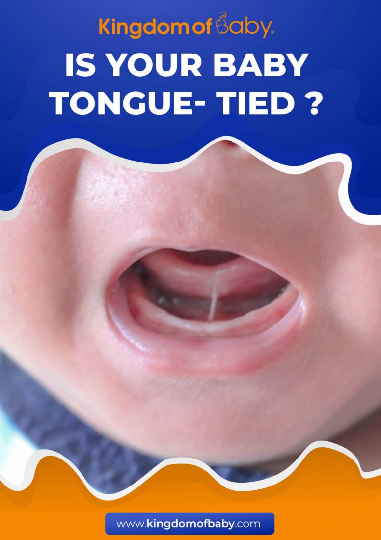 Is Your Baby Tongue-Tied? Find Out How to Deal with it While Breastfeeding