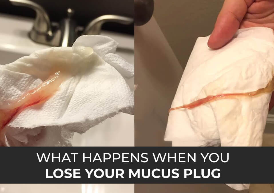 What Happens When You Lose Your Mucus Plug ?