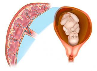 What Is a Chorionic Villus Sampling Test