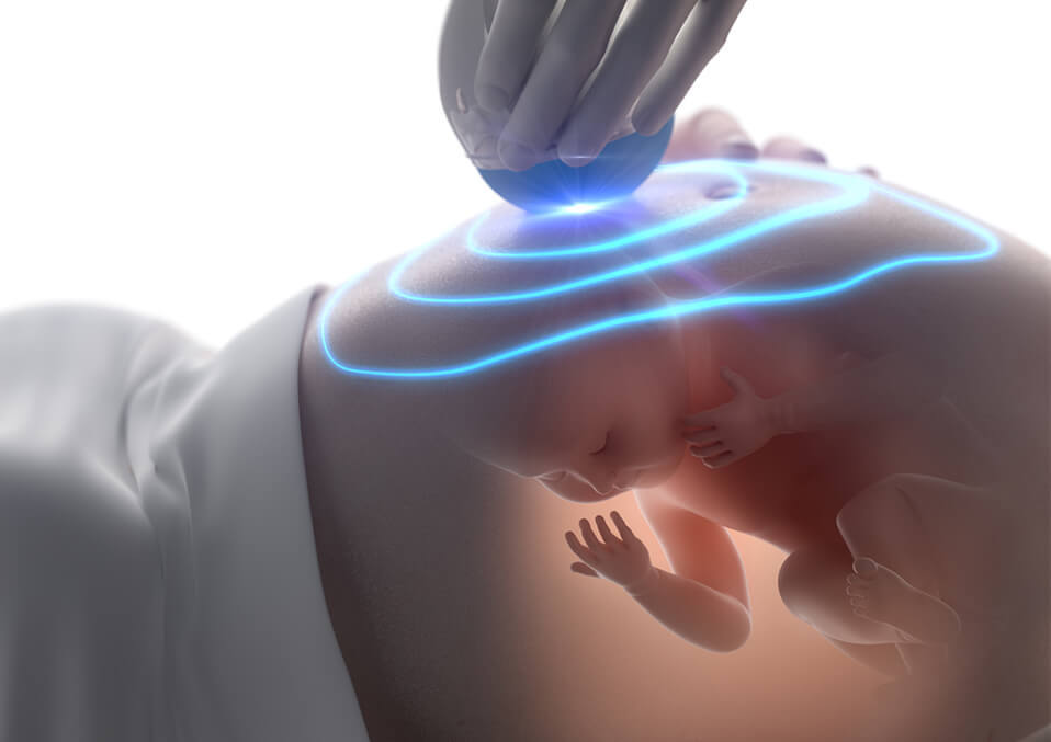 Is 3D/4D ultrasound safe during pregnancy?