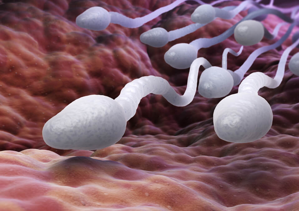 What Is sperm or semen allergy?