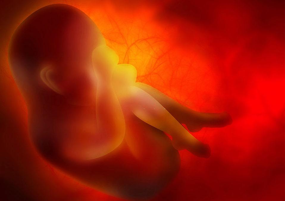 Prenatal ultrasound