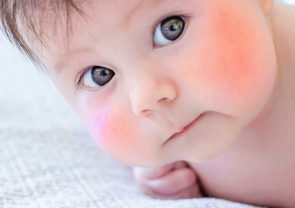 What Do Red Cheeks on Babies Mean?