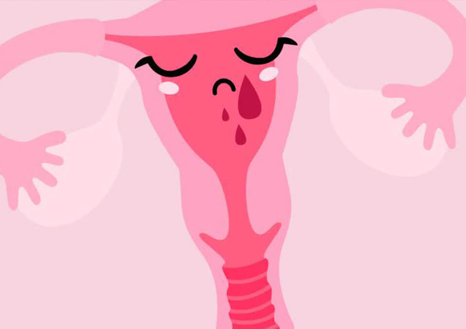 Women’s Health: Everything You Need To Know About Endometriosis