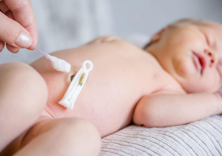 Proper Care and Attention: How to Clean Baby’s Umbilical Cord?
