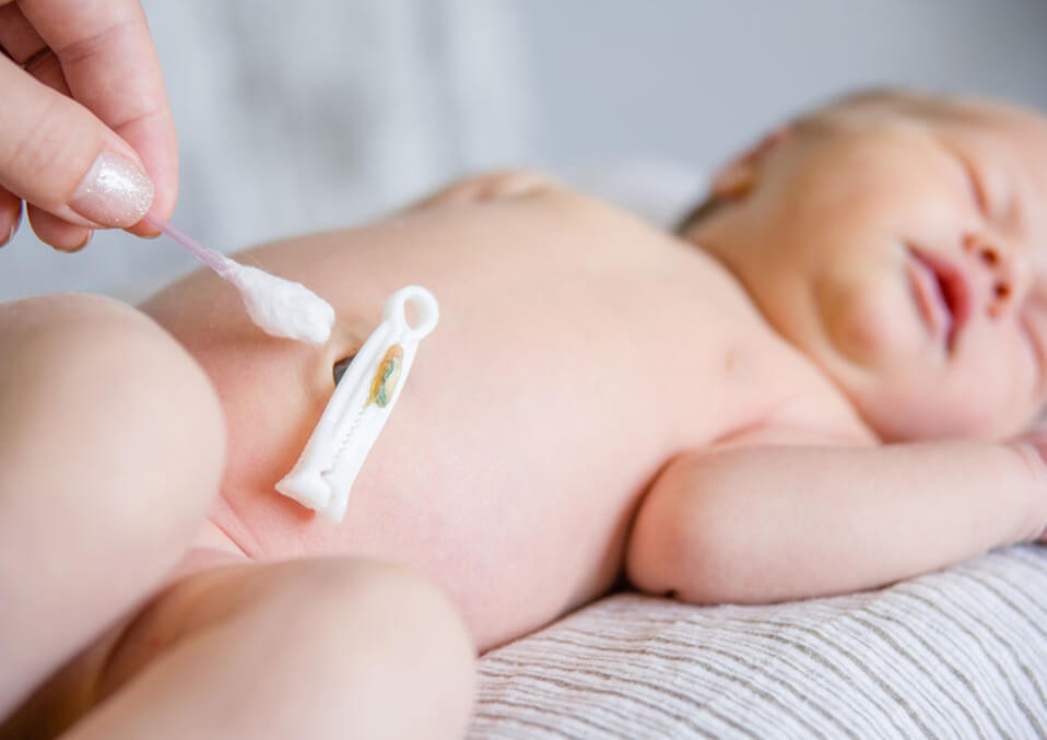 Proper Care and Attention: How to Clean Baby's Umbilical Cord?