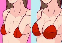 Saggy Breasts: Why Breasts Tend to Droop After Breastfeeding and How to Prevent It?