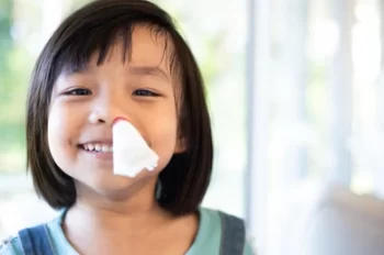 When to Worry about a Nosebleed in Children 