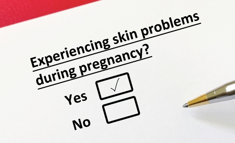 When should I be worried about itching during pregnancy?